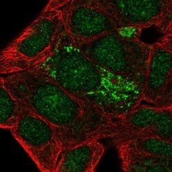 Invitrogen DHRS2 Polyclonal Antibody 100 &mu;L; Unconjugated:Antibodies,