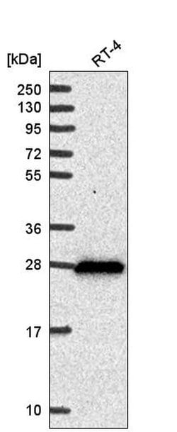 Invitrogen DHRS2 Polyclonal Antibody 100 &mu;L; Unconjugated:Antibodies,