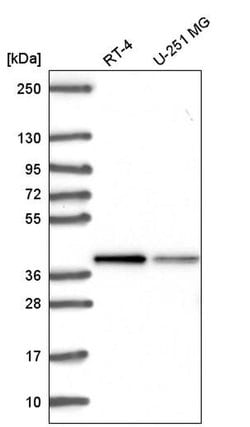 ST8SIA4 Polyclonal Antibody, Invitrogen 100 &mu;L; Unconjugated:Antibodies,
