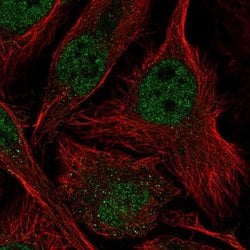 Invitrogen ASF1B Polyclonal Antibody 100 &mu;L; Unconjugated:Antibodies,