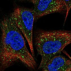Invitrogen COMMD7 Polyclonal Antibody 100 &mu;L; Unconjugated:Antibodies,