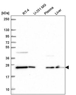 Invitrogen COMMD7 Polyclonal Antibody 100 &mu;L; Unconjugated:Antibodies,