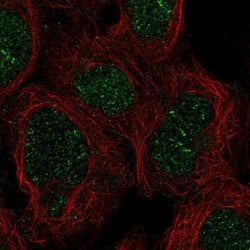 Invitrogen ZNF212 Polyclonal Antibody 100 &mu;L; Unconjugated:Antibodies,