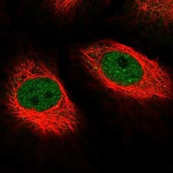 Invitrogen MED10 Polyclonal Antibody 100 &mu;L; Unconjugated:Antibodies,