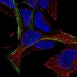 Invitrogen MAGEF1 Polyclonal Antibody 100 &mu;L; Unconjugated:Antibodies,