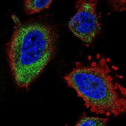 Invitrogen ELOVL5 Polyclonal Antibody 100 &mu;L; Unconjugated:Antibodies,