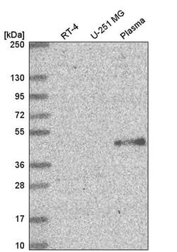 Invitrogen ELOVL5 Polyclonal Antibody 100 &mu;L; Unconjugated:Antibodies,