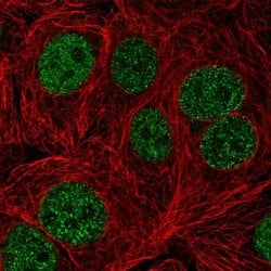 Invitrogen TTC5 Polyclonal Antibody 100 &mu;L; Unconjugated:Antibodies,