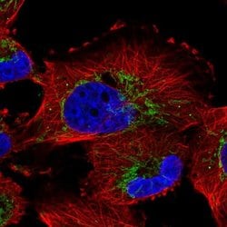 Invitrogen NME7 Polyclonal Antibody 100 &mu;L; Unconjugated:Antibodies,