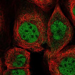 Invitrogen ZMAT3 Polyclonal Antibody 100 &mu;L; Unconjugated:Antibodies,