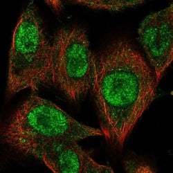 Invitrogen CMIP Polyclonal Antibody 100 &mu;L; Unconjugated:Antibodies,
