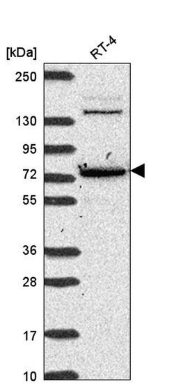 Invitrogen CMIP Polyclonal Antibody 100 &mu;L; Unconjugated:Antibodies,