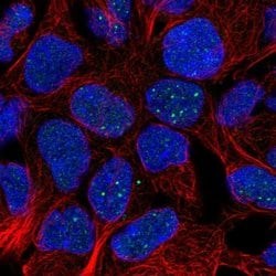 Invitrogen FAM69B Polyclonal Antibody 100 &mu;L; Unconjugated:Antibodies,