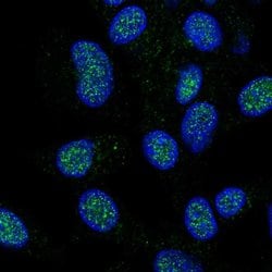 HECTD1 Polyclonal Antibody:Antibodies, Polyclonal