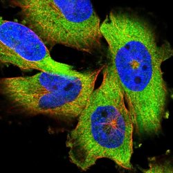 Invitrogen GLD2 Polyclonal Antibody 100 &mu;L; Unconjugated:Antibodies,