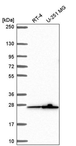 Invitrogen MRPS26 Polyclonal Antibody 100 &mu;L; Unconjugated:Antibodies,