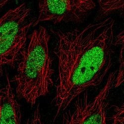 Invitrogen C19orf57 Polyclonal Antibody 100 &mu;L; Unconjugated:Antibodies,