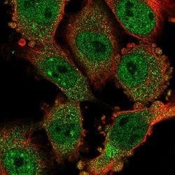 Invitrogen CCDC159 Polyclonal Antibody 100 &mu;L; Unconjugated:Antibodies,