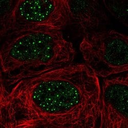 Invitrogen FBXO48 Polyclonal Antibody 100 &mu;L; Unconjugated:Antibodies,