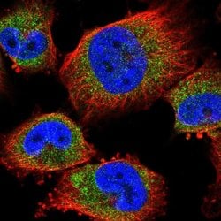 Invitrogen TMEM259 Polyclonal Antibody 100 &mu;L; Unconjugated:Antibodies,