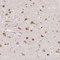 Invitrogen PNMAL2 Polyclonal Antibody 100 &mu;L; Unconjugated:Antibodies,