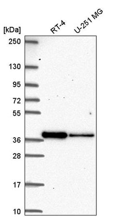 Invitrogen DTWD2 Polyclonal Antibody 100 &mu;L; Unconjugated:Antibodies,