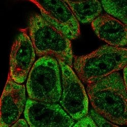 Invitrogen SLFNL1 Polyclonal Antibody 100 &mu;L; Unconjugated:Antibodies,