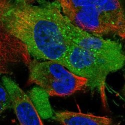 Invitrogen Neuropilin 2 Polyclonal Antibody 100 &mu;L; Unconjugated:Antibodies,
