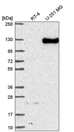 Invitrogen Neuropilin 2 Polyclonal Antibody 100 &mu;L; Unconjugated:Antibodies,