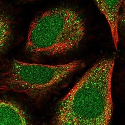 Invitrogen POLE4 Polyclonal Antibody 100 &mu;L; Unconjugated:Antibodies,