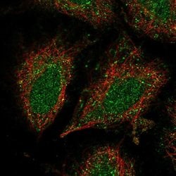 Invitrogen CCDC122 Polyclonal Antibody 100 &mu;L; Unconjugated:Antibodies,