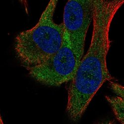 Invitrogen RPS18 Polyclonal Antibody 100 &mu;L; Unconjugated:Antibodies,