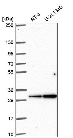 Invitrogen Connexin 30.3 Polyclonal Antibody 100 &mu;L; Unconjugated:Antibodies,