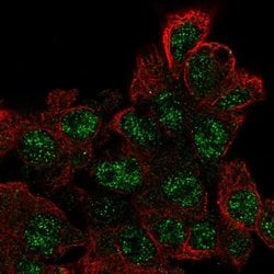 Invitrogen C17orf96 Polyclonal Antibody 100 &mu;L; Unconjugated:Antibodies,