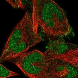 Invitrogen FBXO41 Polyclonal Antibody 100 &mu;L; Unconjugated:Antibodies,