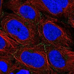 Invitrogen ARVCF Polyclonal Antibody 100 &mu;L; Unconjugated:Antibodies,