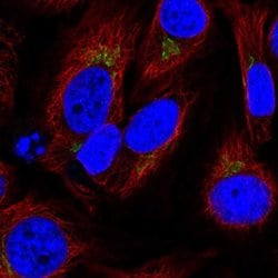 Invitrogen SPCS1 Polyclonal Antibody 100 &mu;L | Buy Online | Invitrogen&trade; | Fisher Scientific