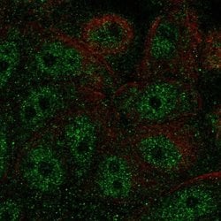 FBP2 Polyclonal Antibody, Invitrogen 100 &mu;L; Unconjugated:Antibodies,
