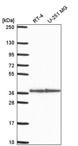 Invitrogen STX12 Polyclonal Antibody 100 &mu;L; Unconjugated:Antibodies,