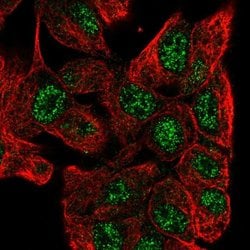 Invitrogen ZNF517 Polyclonal Antibody 100 &mu;L; Unconjugated:Antibodies,