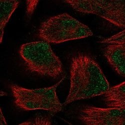 Invitrogen PKNOX2 Polyclonal Antibody 100 &mu;L; Unconjugated:Antibodies,