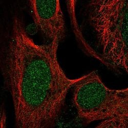 Invitrogen SWI5 Polyclonal Antibody 100 &mu;L; Unconjugated:Antibodies,