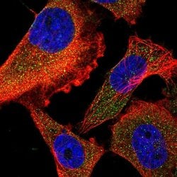 Invitrogen FIR Polyclonal Antibody 100 &mu;L; Unconjugated:Antibodies,