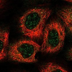 Invitrogen HEATR5B Polyclonal Antibody 100 &mu;L; Unconjugated:Antibodies,