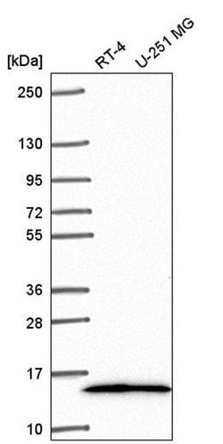 Invitrogen NR2C2AP Polyclonal Antibody 100 &mu;L; Unconjugated:Antibodies,