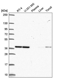 Invitrogen CCDC94 Polyclonal Antibody 100 &mu;L | Buy Online | Invitrogen&trade; | Fisher Scientific