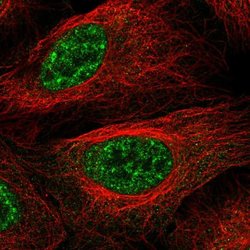 Invitrogen LHX4 Polyclonal Antibody 100 &mu;L; Unconjugated:Antibodies,