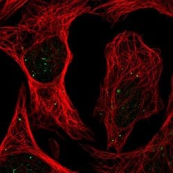 Invitrogen PLAGL1 Polyclonal Antibody 100 &mu;L; Unconjugated:Antibodies,