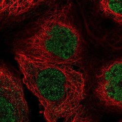Invitrogen C5orf54 Polyclonal Antibody 100 &mu;L; Unconjugated:Antibodies,