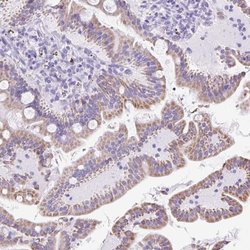 Invitrogen Cytokeratin 12 Polyclonal Antibody 100 &mu;L; Unconjugated:Antibodies,